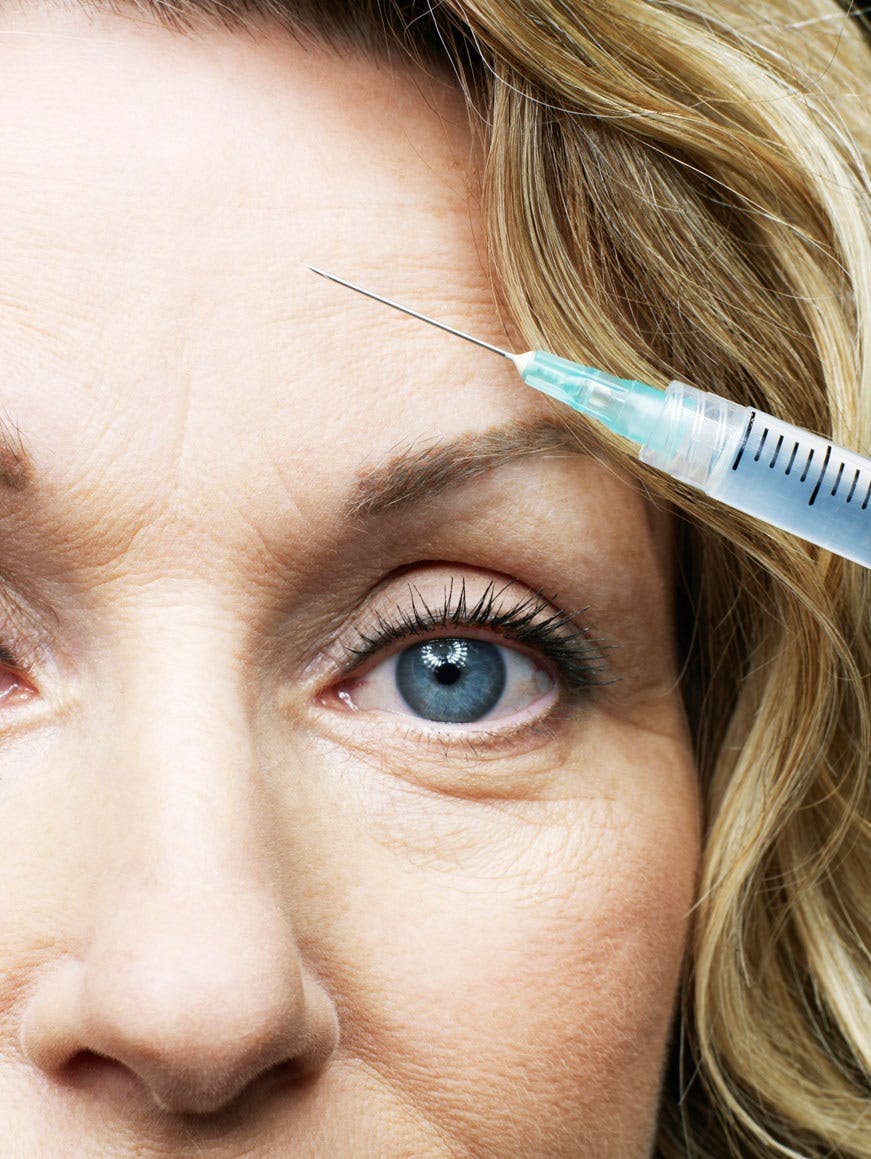 Botox botox
